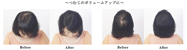 つむじのボリュームアップに