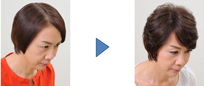 「活毛ウィッグ　フィールファイン」（ダークブラウン）着用イメージ　使用前（左）、使用後（右）