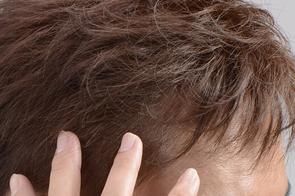 オリジナル 前髪 が 薄く なっ てき た 髪型 無料のヘアスタイルのアイデア