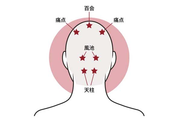 アデランスが教える 知っておきたい薄毛 抜け毛改善のための育毛方法5つ カミわざ