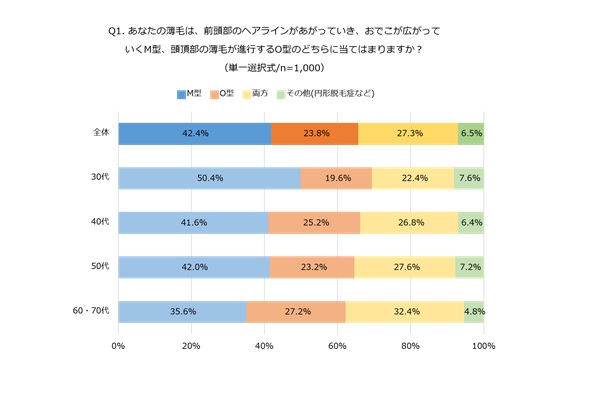 男性向け 薄毛 抜け毛の原因と今すぐできる対策方法徹底調査 カミわざ