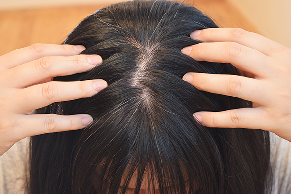 おでこが広い女性必見 かわいい前髪のヘアアレンジ法をご紹介 カミわざ