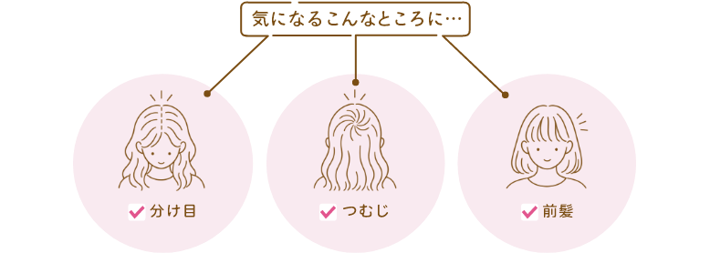 気になる分け目・つむじ・前髪に