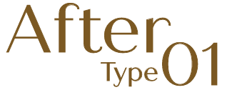 After Type01
