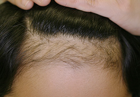 写真　抗がん剤