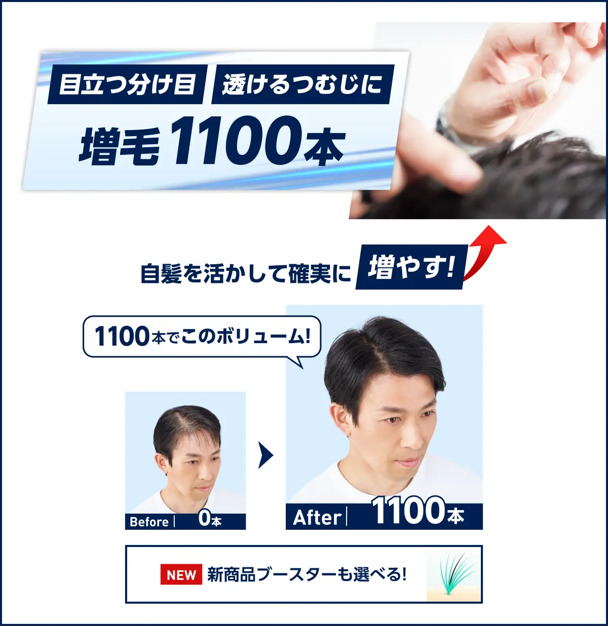 目立つ分け目、透けるつむじに　増毛1100本の仕上がりイメージ写真。自髪を活かして確実に増やす!Before0本からAfter1100本装着後の比較写真、1100本でこのボリューム!新商品ブースターも選べる!