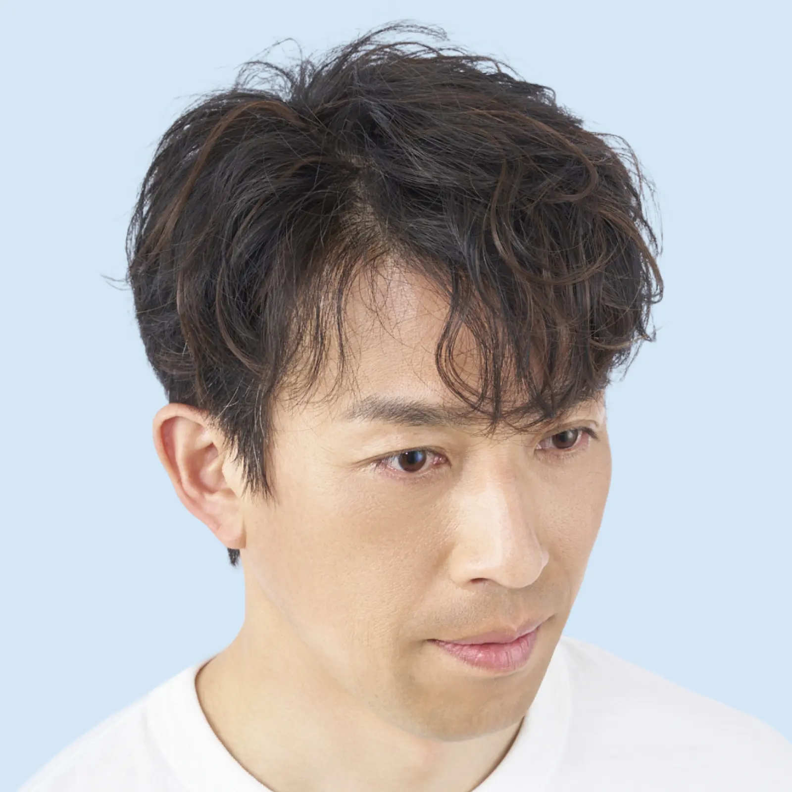 本田さん 増毛約7500本の頭髪