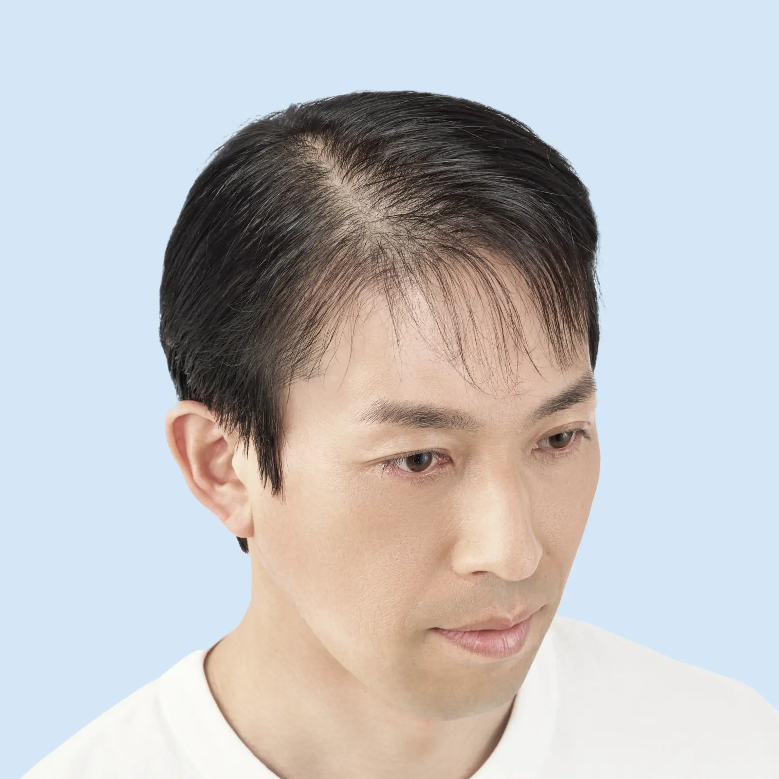 本田さん 施術前の頭髪