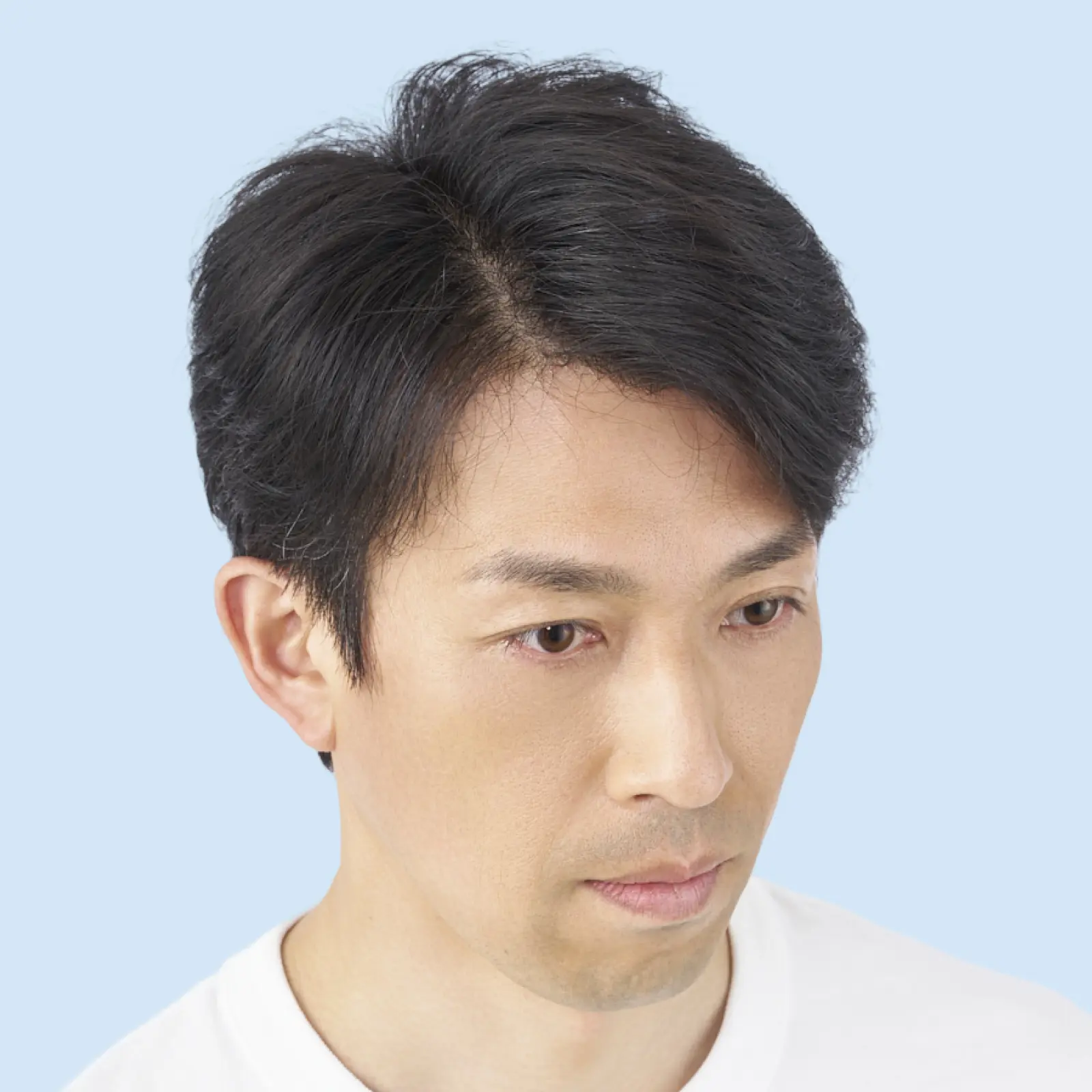 本田さん 増毛約4,500本の頭髪