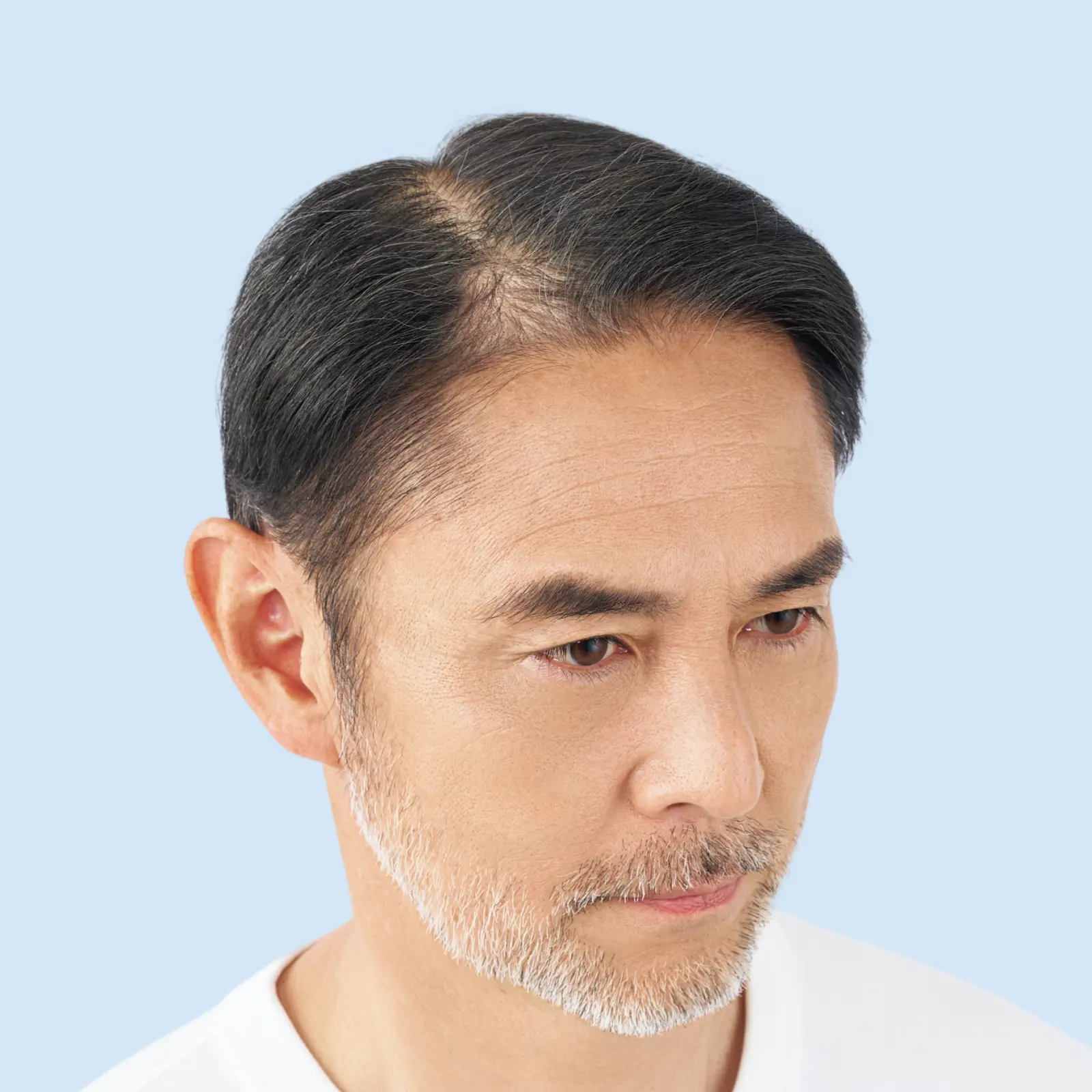 関さん 施術前の頭髪