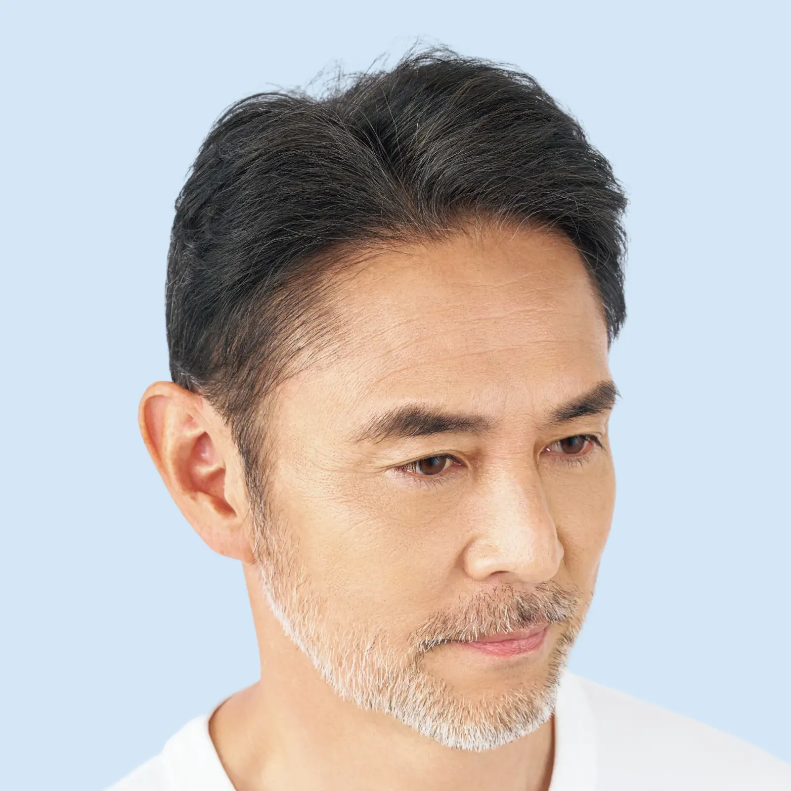 関さん 増毛約3000本の頭髪