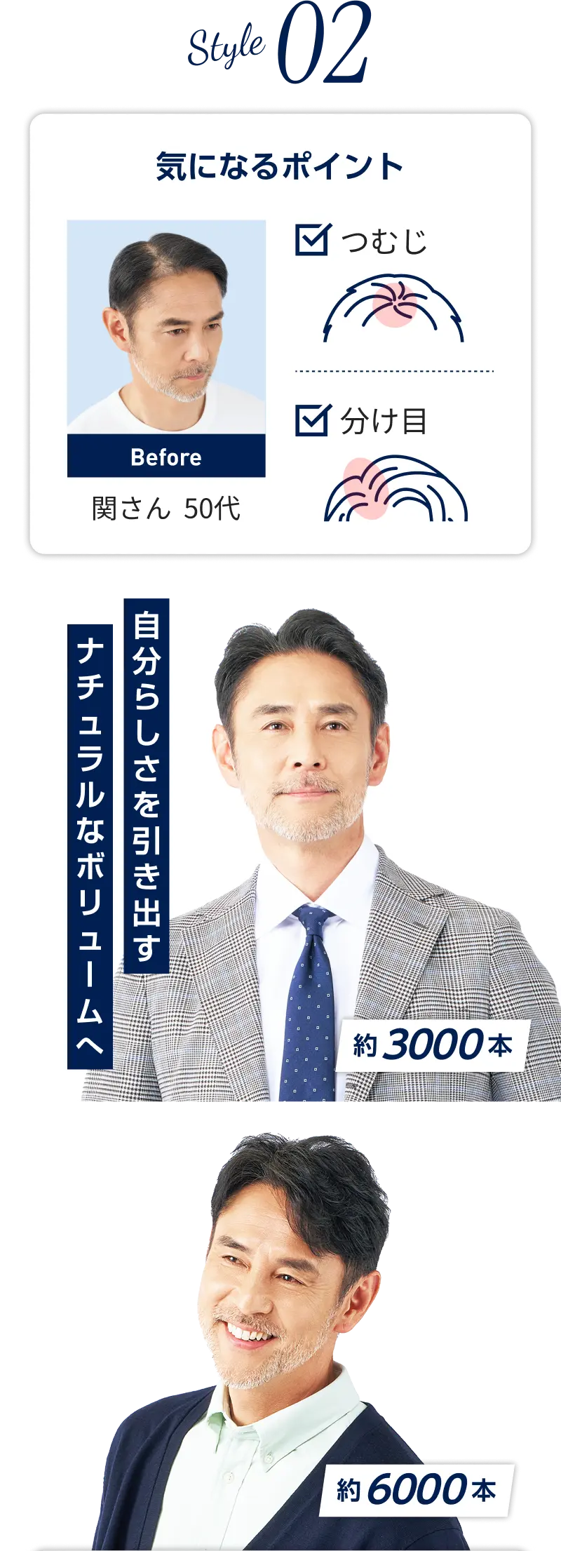 増毛後の本田さんのスタイル（約4500本）