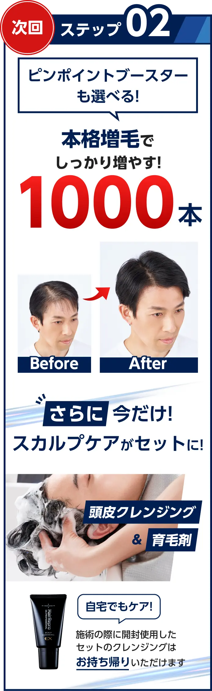 ステップ02　次回　Before/After写真　ピンポイントブースターも選べる!本格増毛でしっかり増やす!1000本　さらに今だけ!スカルプケアがセットに!頭皮クレンジング&育毛剤の写真　自宅でもケア!使用したクレンジングはお持ち帰りいただけます