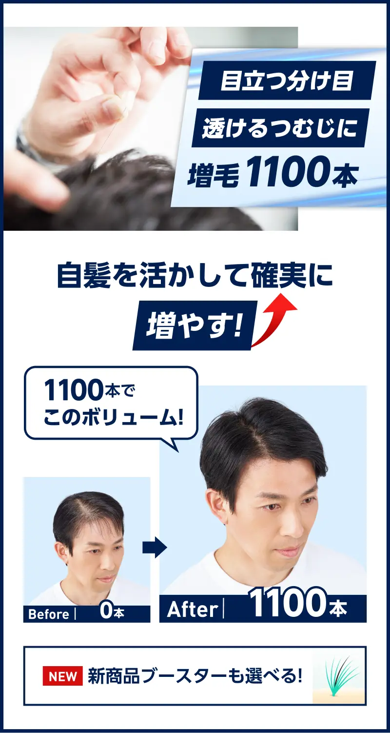 目立つ分け目、透けるつむじに　増毛1100本の仕上がりイメージ写真。自髪を活かして確実に増やす!Before0本からAfter1100本装着後の比較写真、1100本でこのボリューム!新商品ブースターも選べる!