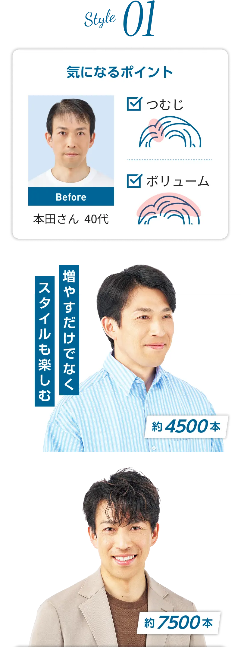 増毛後の本田さんのスタイル（約4500本）