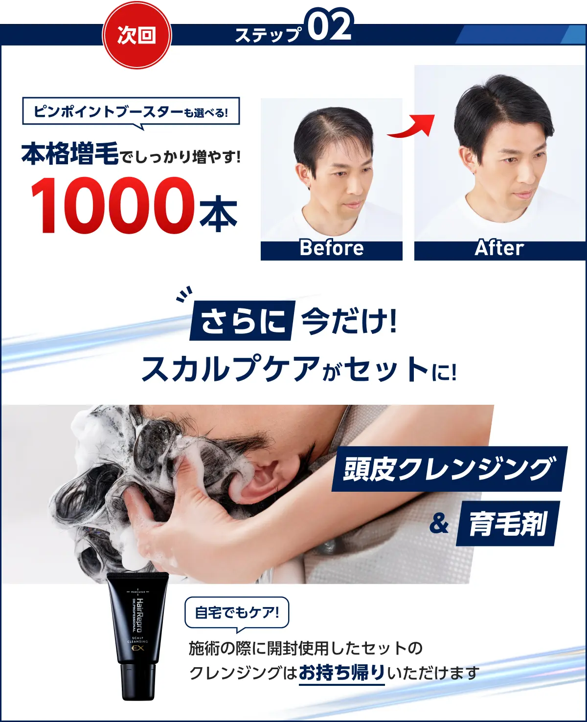 ステップ02　次回　Before/After写真　ピンポイントブースターも選べる!本格増毛でしっかり増やす!1000本　さらに今だけ!スカルプケアがセットに!頭皮クレンジング&育毛剤の写真　自宅でもケア!使用したクレンジングはお持ち帰りいただけます