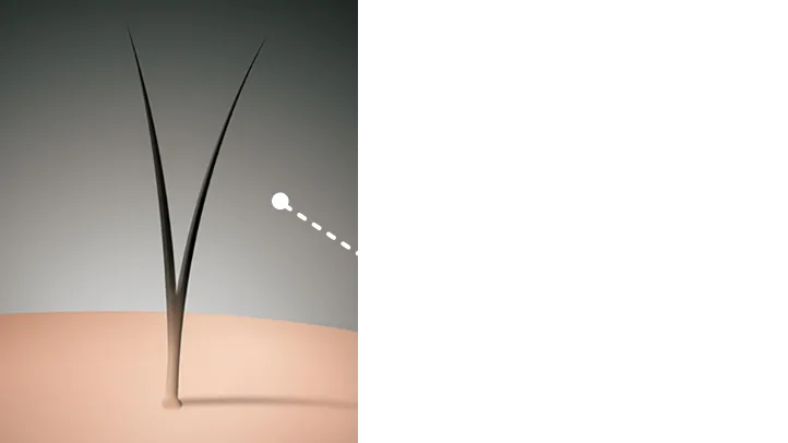 インビジブル毛植イメージ図