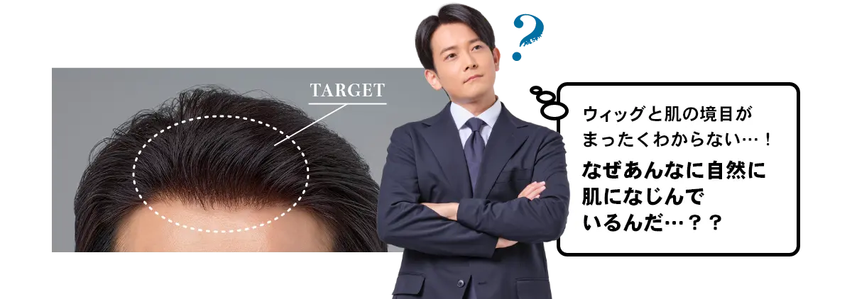 ウィッグと肌の境目がまったくわからない…!なぜあんなに自然に肌になじんでいるんだ…??