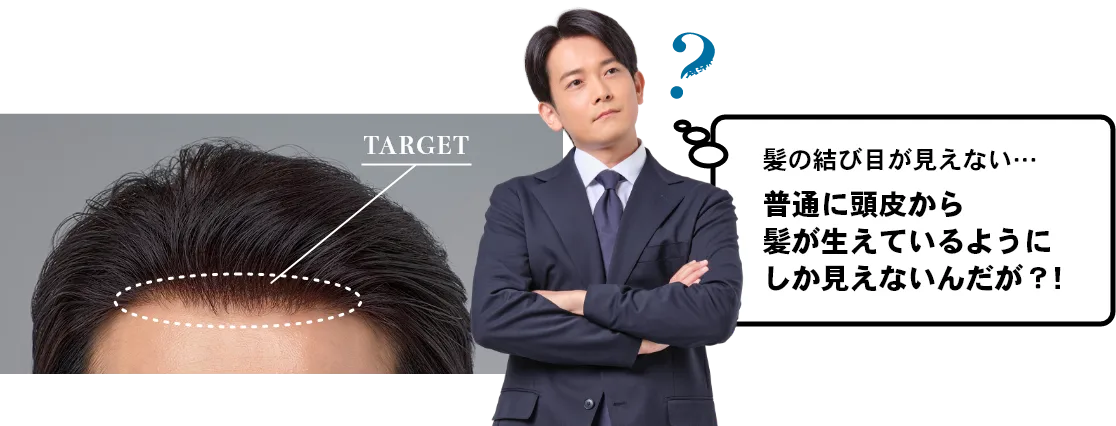 髪の結び目が見えない…普通に頭皮から髪が生えているようにしか見えないんだが?!