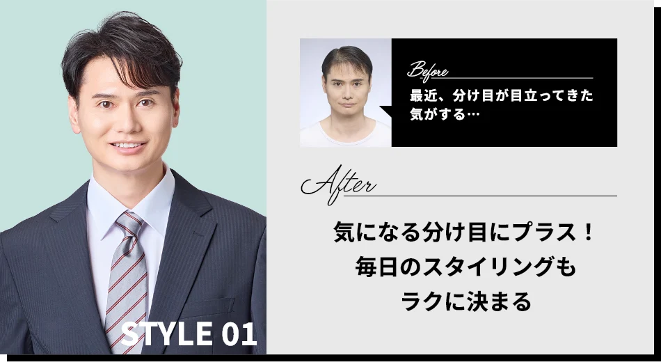 STYLE01 BEFORE：最近、分け目が目立ってきた気がする…　AFTER：気になる分け目にプラス！毎日のスタイリングもラクに決まる