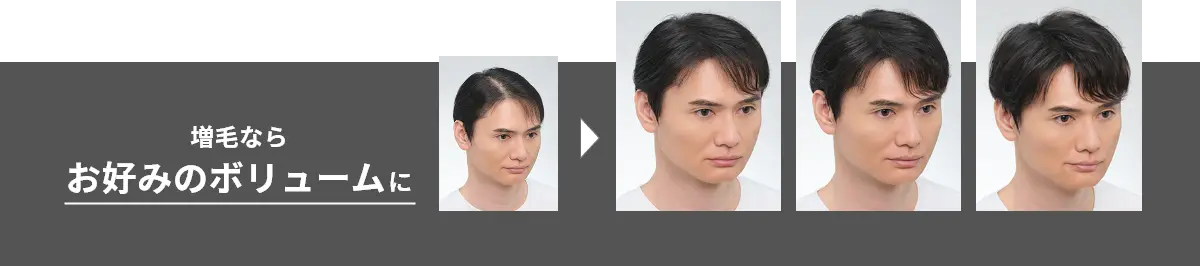 増毛ならお好みのボリュームに