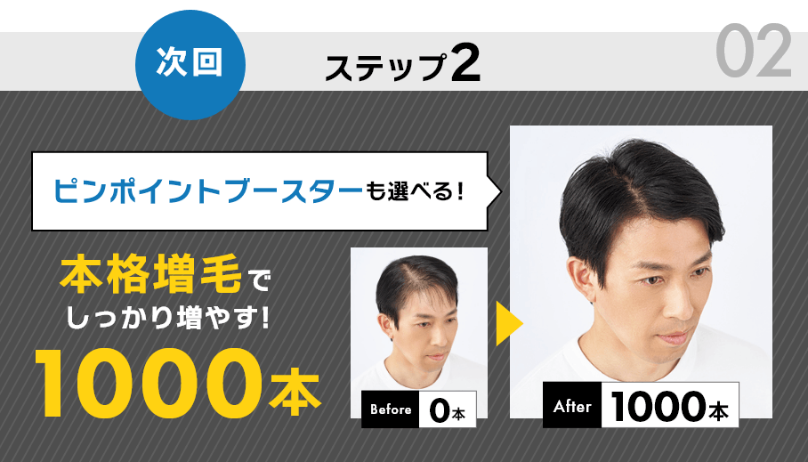 ステップ2 本格増毛でしっかり増やす!1000本