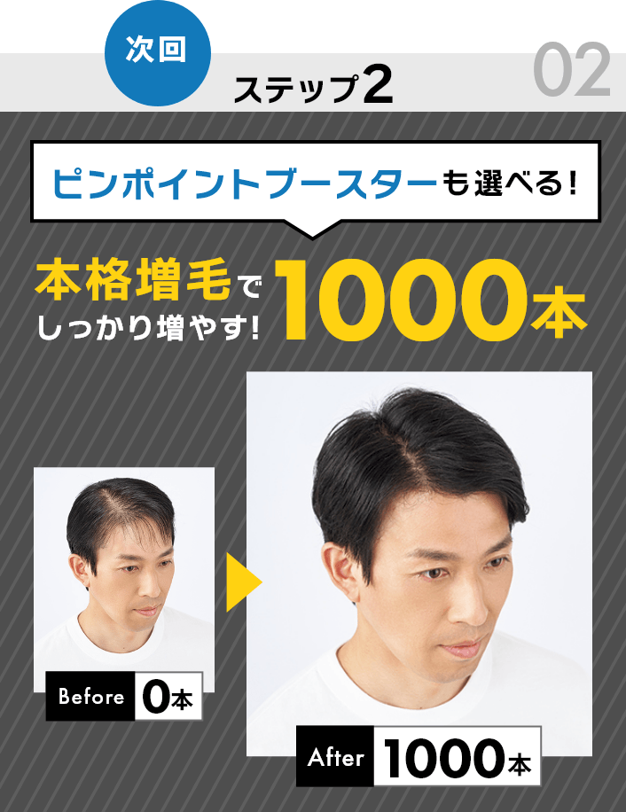 ステップ2　本格増毛でしっかり増やす！1000本