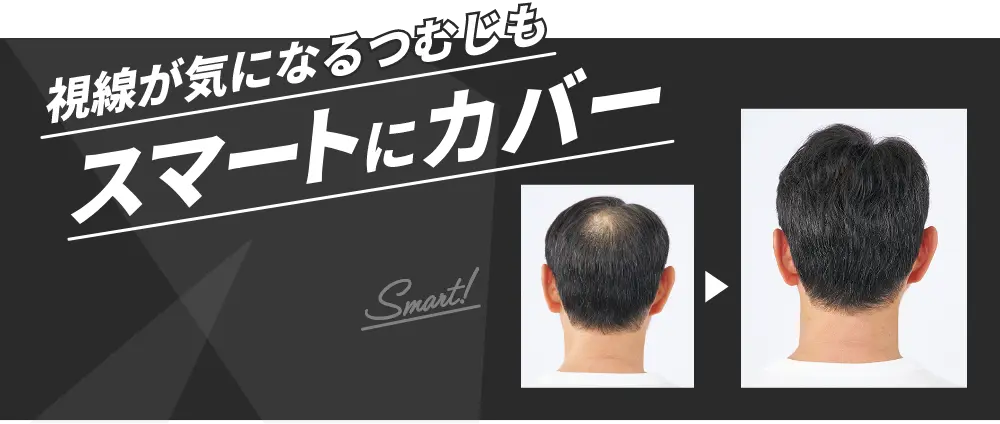 視線が気になるつむじもスマートにカバー