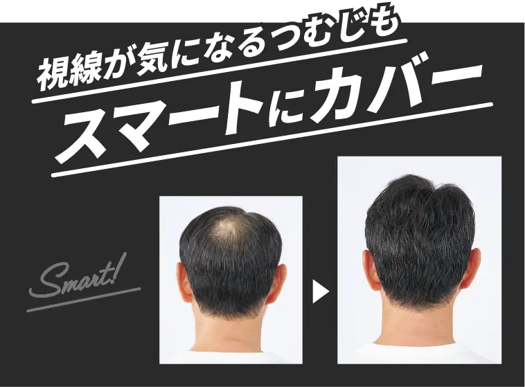 視線が気になるつむじもスマートにカバー