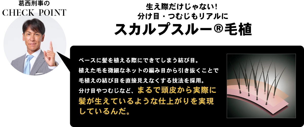 葛西刑事のCHECK POINT 生え際だけじゃない！分け目・つむじもリアルに　スカルプスルー®毛植  ベースに髪を植える際にできてしまう結び目。植えた毛を微細なネットの編み目から引き抜くことで毛植えの結び目を直接見えなくする技法を採用。分け目やつむじなど、まるで頭皮から実際に髪が生えているような仕上がりを実現しているんだ。