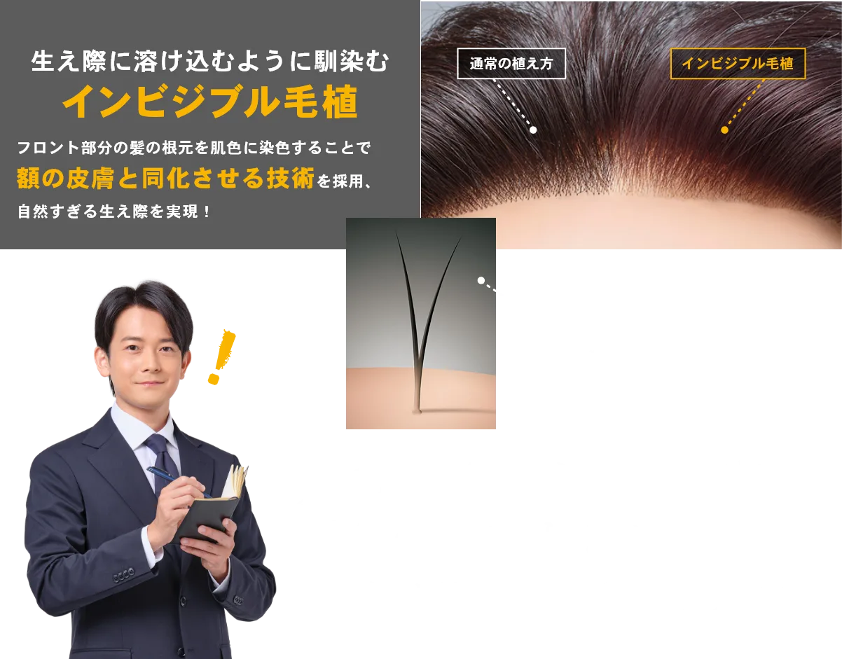 髪の根元にそんな秘密が隠されていたとは…！目の付け所がすごいな、アデランス！