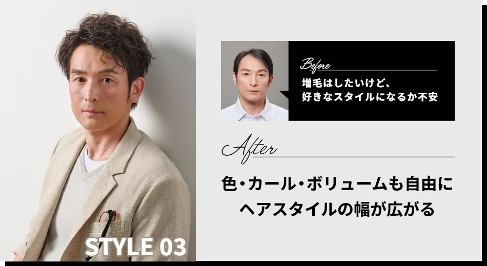 STYLE03 BEFORE：増毛はしたいけど、スキなスタイルになるか不安　AFTER：色・カール・ボリュームも自由にヘアスタイルの幅が広がる