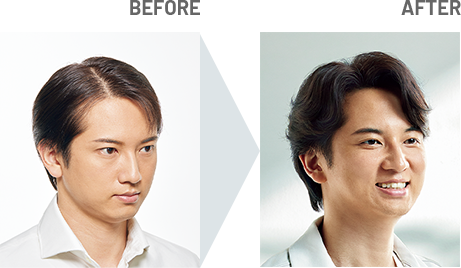 BEFORE・AFTER