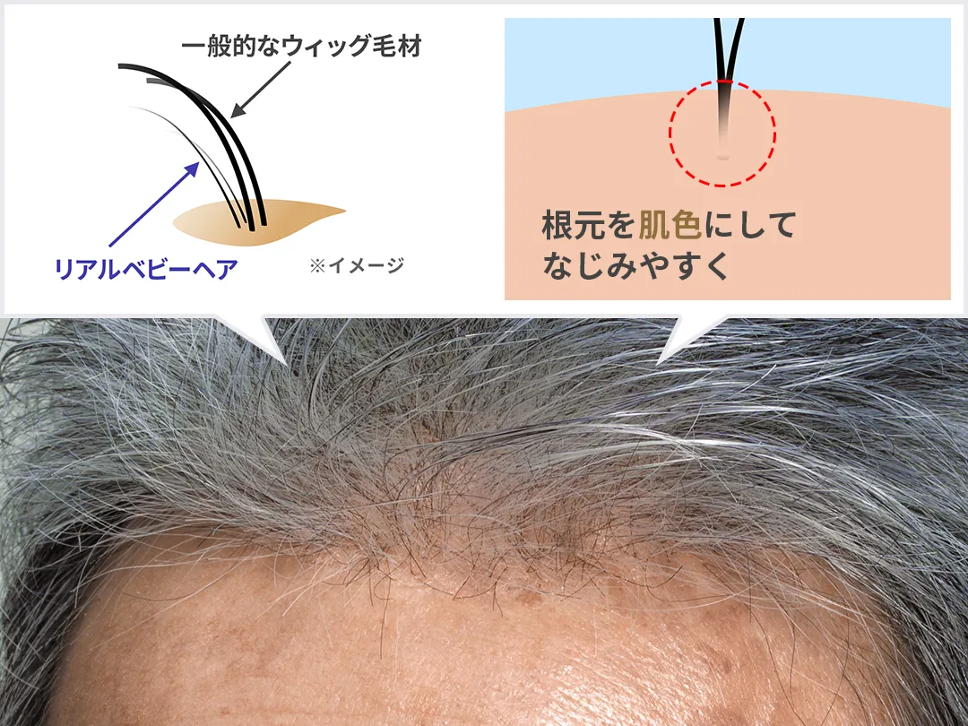 自然な生え際の技術概要図