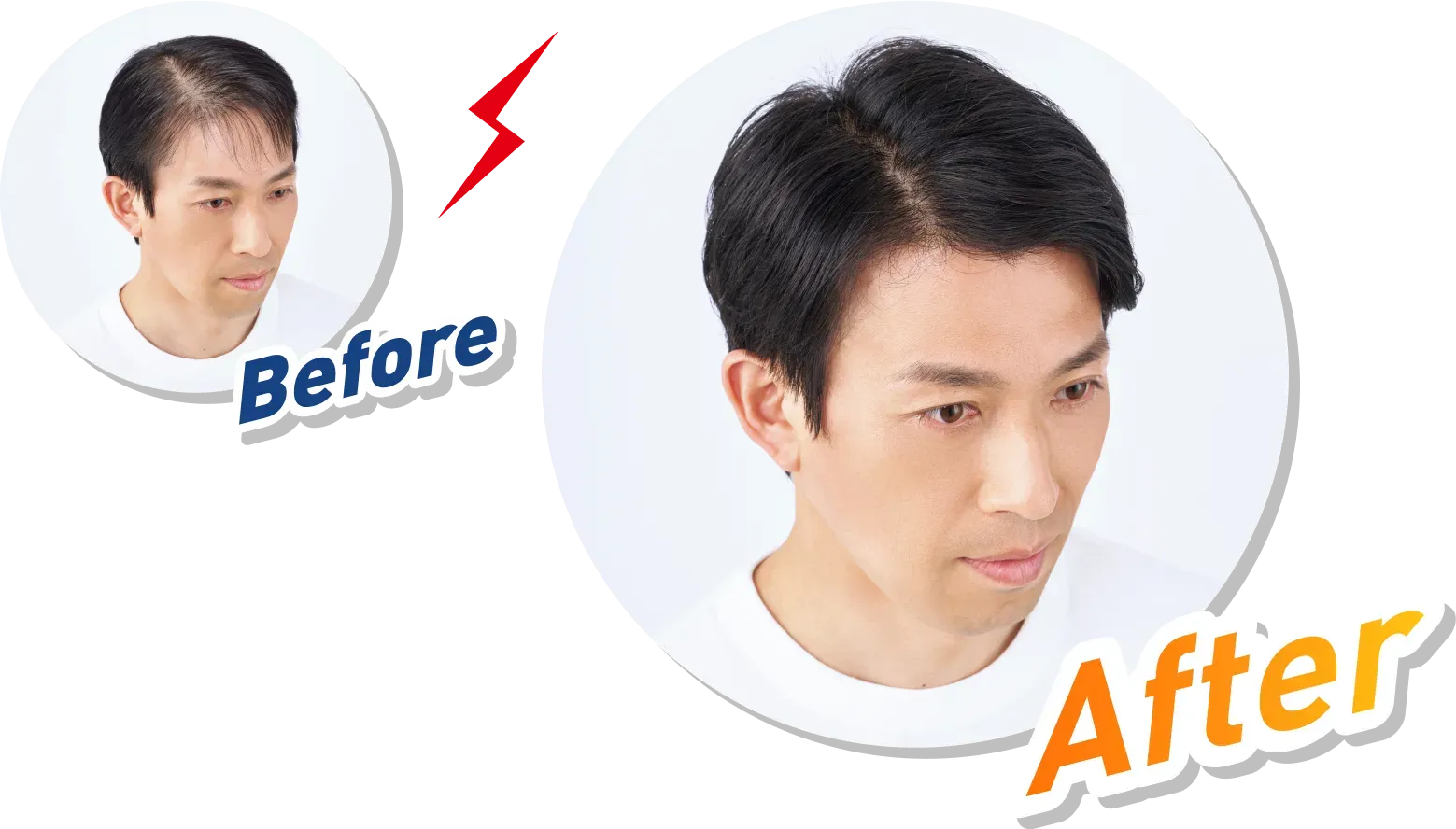 Before Afterの図