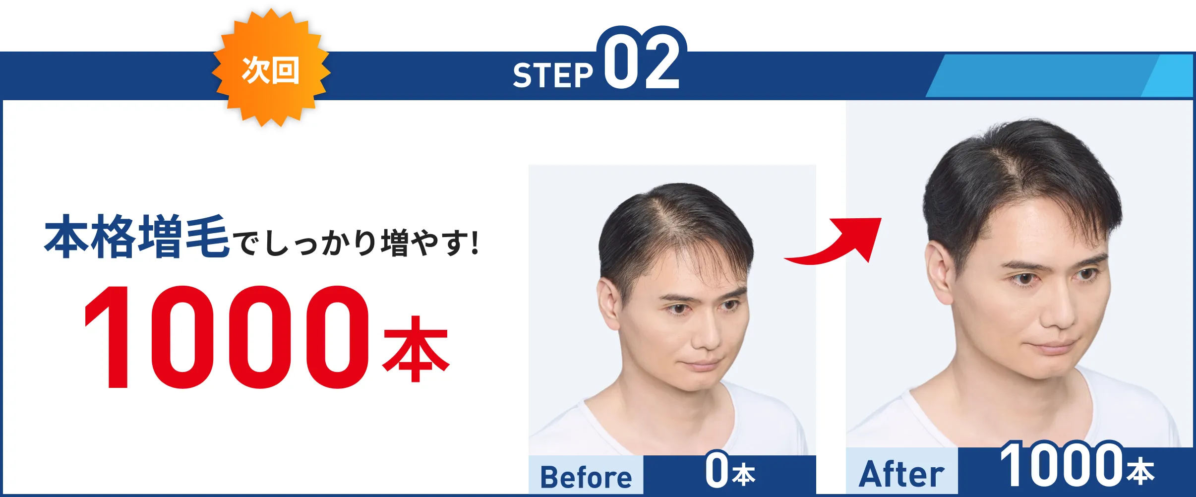 STEP02 本格増毛でしっかり増やす! 1000本