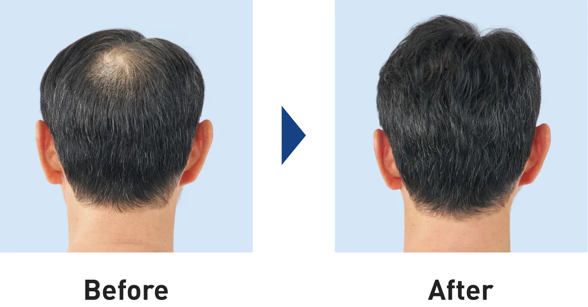 Before Afterの図