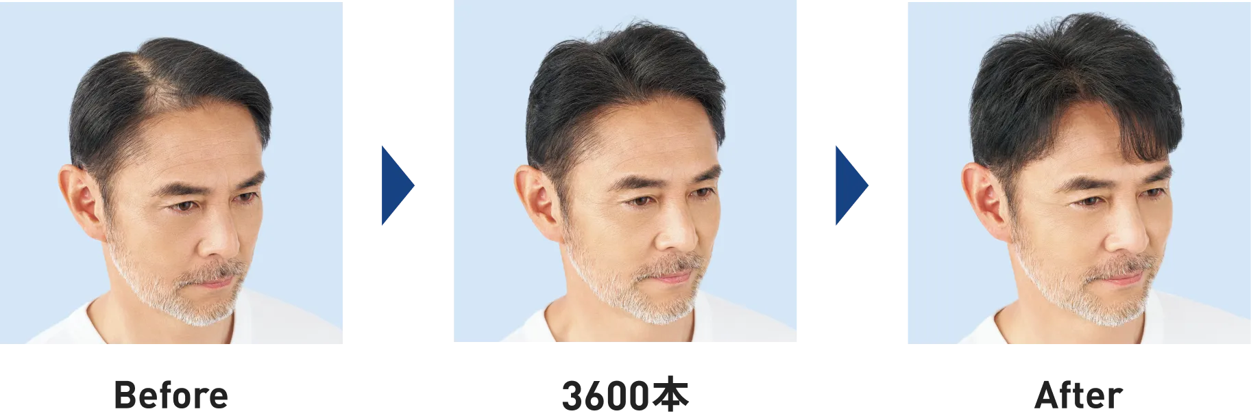 Before Afterの図