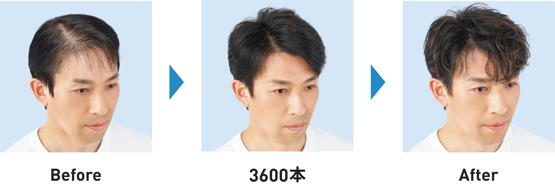 Before Afterの図