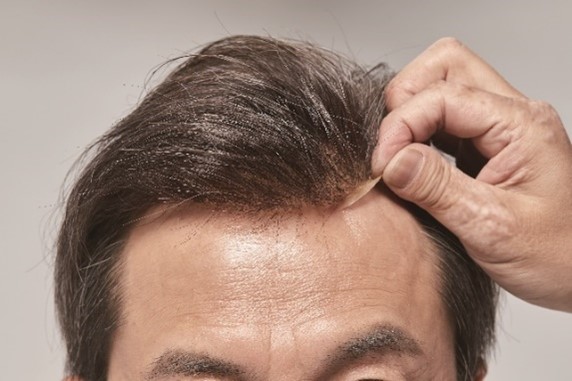 ヘアシステム取り付けイメージ.jp